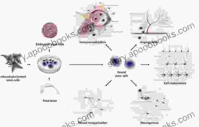 A Depiction Of Stem Cell Therapy For Neurological Injuries, With Stem Cells Migrating To Damaged Areas And Promoting Repair. Re Engineering Of The Damaged Brain And Spinal Cord: Evidence Based Neurorehabilitation (Acta Neurochirurgica Supplement 93)