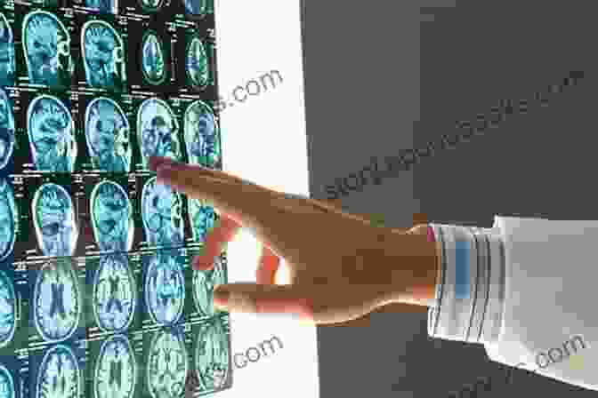 A Portrait Of A Patient Recovering From A Neurological Injury, Showcasing The Positive Impact Of Neuroregeneration Therapies. Re Engineering Of The Damaged Brain And Spinal Cord: Evidence Based Neurorehabilitation (Acta Neurochirurgica Supplement 93)