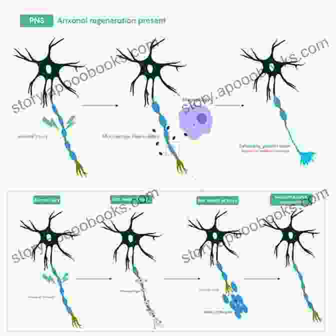 An Illustration Of The Neuroregeneration Process, Where Damaged Neurons Are Repaired And Replaced. Re Engineering Of The Damaged Brain And Spinal Cord: Evidence Based Neurorehabilitation (Acta Neurochirurgica Supplement 93)