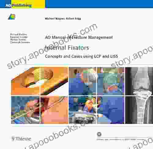 AO Manual Of Fracture Management: Internal Fixators: Concepts And Cases Using LCP/LISS (AO Manual Of Fracture Management Series)