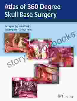 Atlas Of 360 Degree Skull Base Surgery