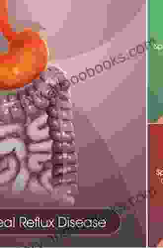 Diagnosis And Treatment Of Gastroesophageal Reflux Disease