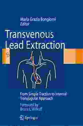 Transvenous Lead Extraction: From Simple Traction To Internal Transjugular Approach