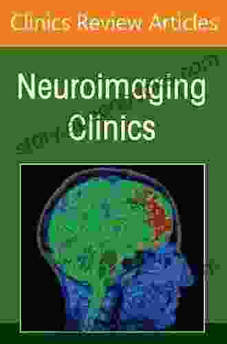 Skull Base Neuroimaging An Issue Of Neuroimaging Clinics Of North America E (The Clinics: Internal Medicine)