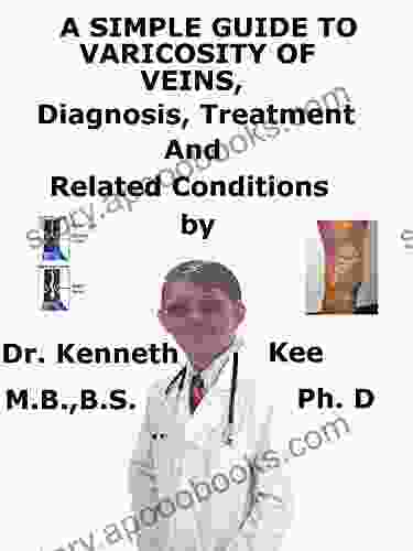 A Simple Guide To Varicosity of Veins Diagnosis Treatment And Related Conditions